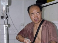 Saldırıda yaralanan Çinli işçi