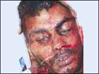 مشتبہ حملہ آور کی تصویر