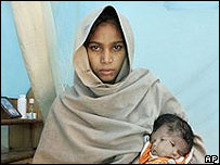 Bebê Lali, que nasceu com duas faces, no colo de sua mãe, Sushma