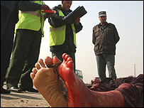 پاهای خونين يک قربانی بمبگذاری انتحاری در کابل