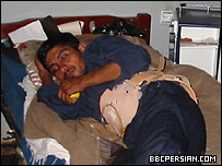 یک کارگر مجروح افغان که می گوید کمرش در اثر پرتاب شدن از ساختمان شکسته است