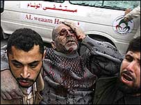 Một nạn nhân thường dân Palestin được đưa vào bệnh viện cấp cứu ở Gaza City hôm 27.12.08