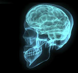 X-ray image of a human head, showing the brain