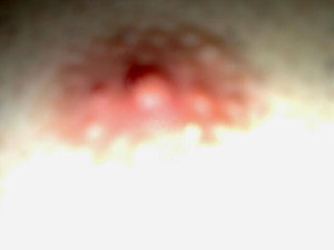 whose_nipple.jpg