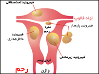 بی نظمی عادت ماهوار