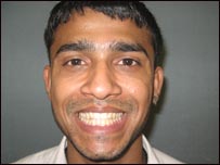 शीतकारी प्राणायाम