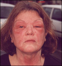 اضرار ادويه خود سر